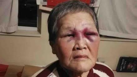 SF grandmother who fought off attacker to donate all $900k raised back to Asian American community