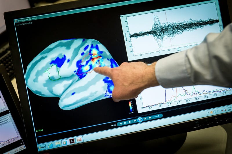 Magnetoencephalography (MEG) Laboratory scientist, Mihai Popescu points out areas of magnetic activity in a brain on a display at the National Intrepid Center of Excellence (NICoE) at Walter Reed National Military Medical Center in Bethesda, Md., Mar. 16, 2017. 