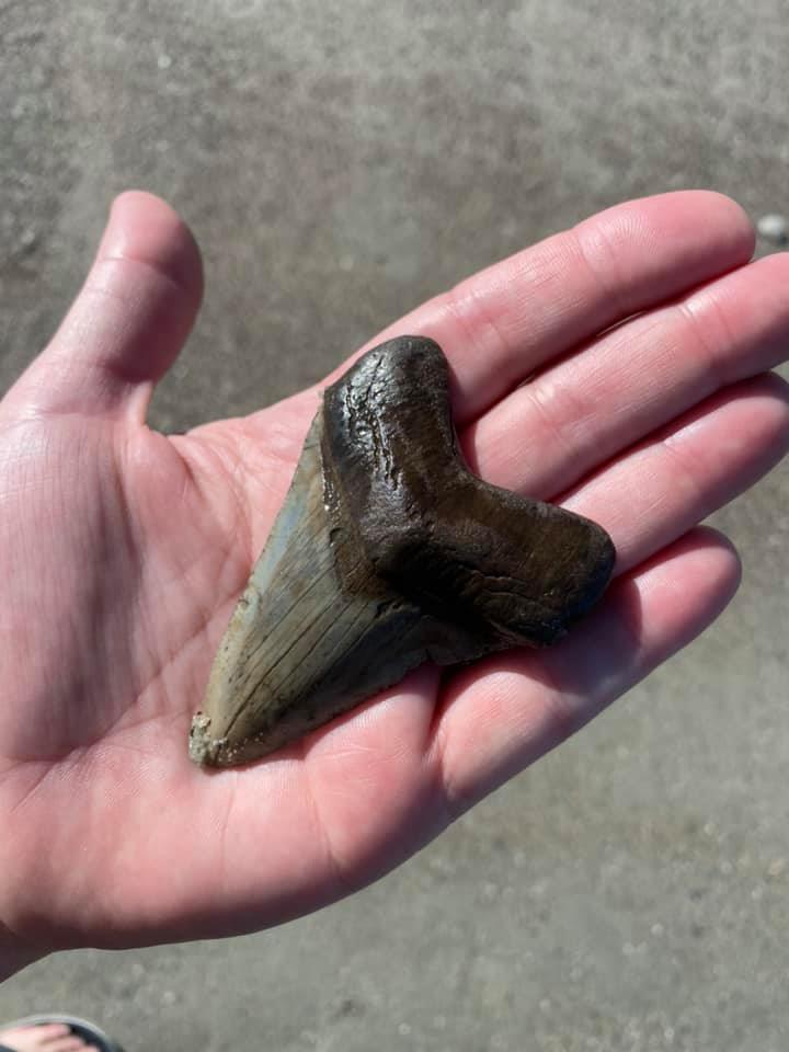 Tooth