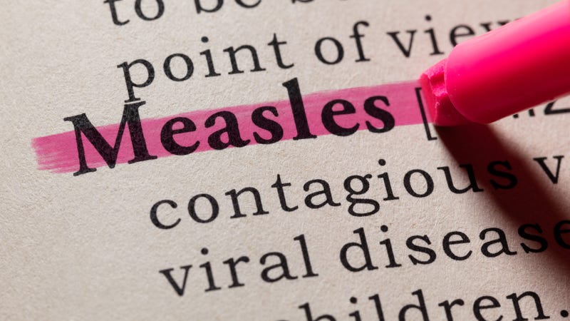 Measles