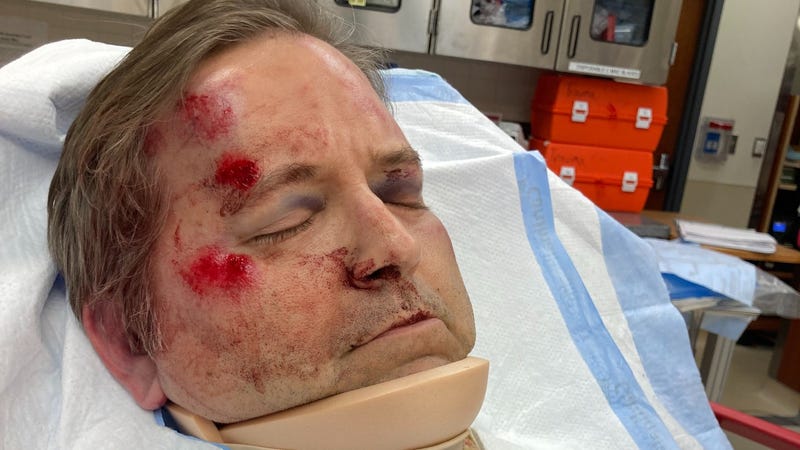 Ben Wheelock in hospital