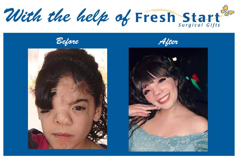 Fresh Start with the Fab Five Auction