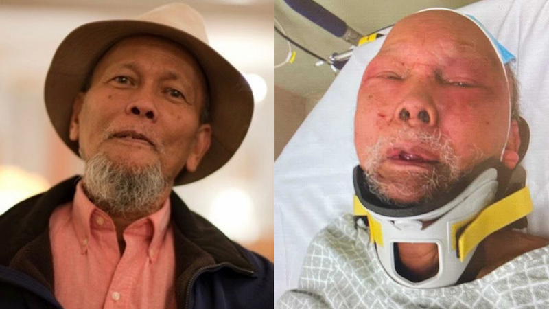 83-year-old attacked in his home on New Year’s Eve has died