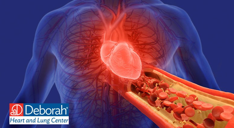 Advances in Cardiac Surgery