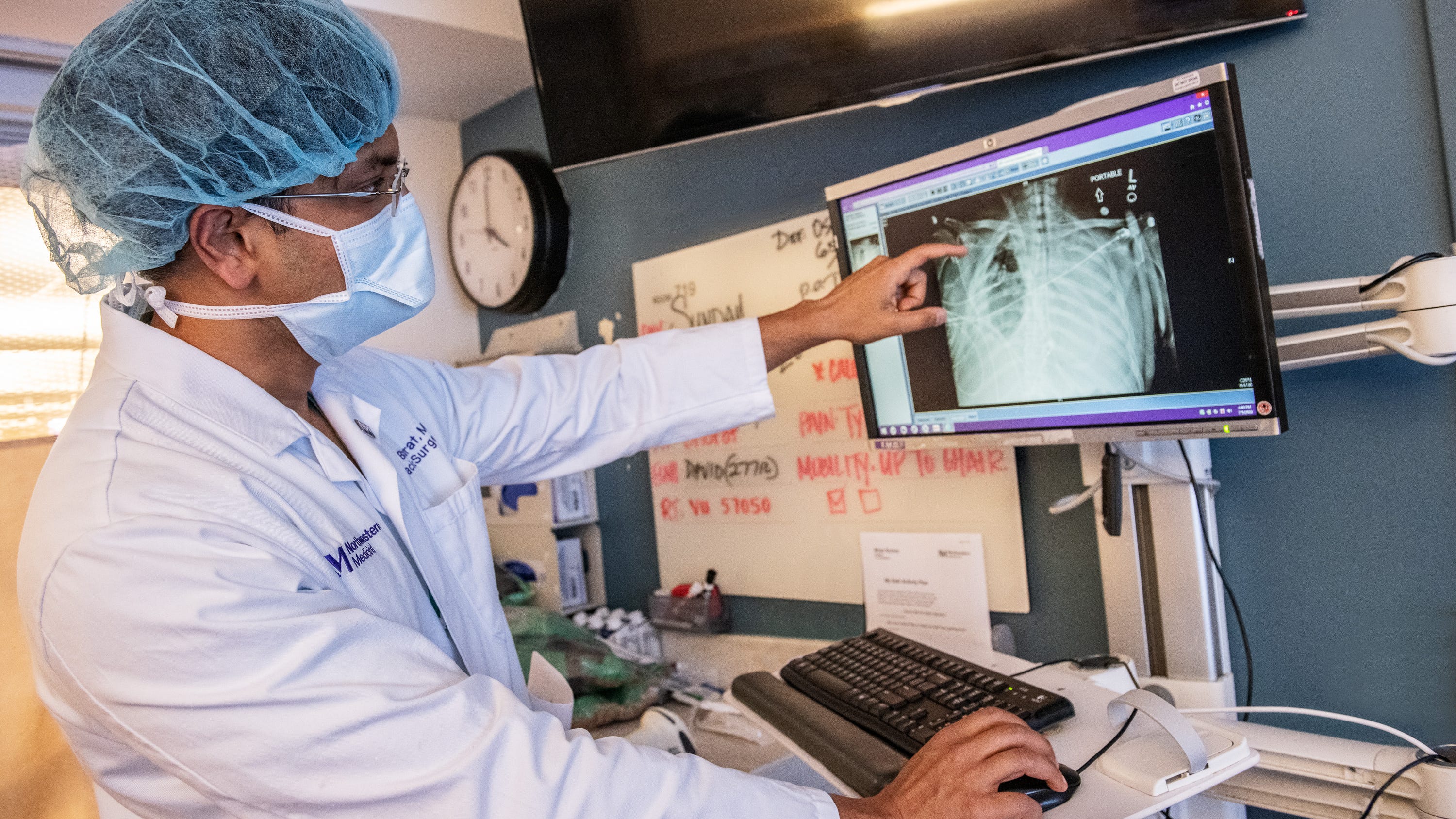 COVID-19 can result in irreversible lung damage requiring lung transplantation: Study