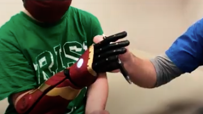 8-year-old amputee gets Iron Man bionic arm