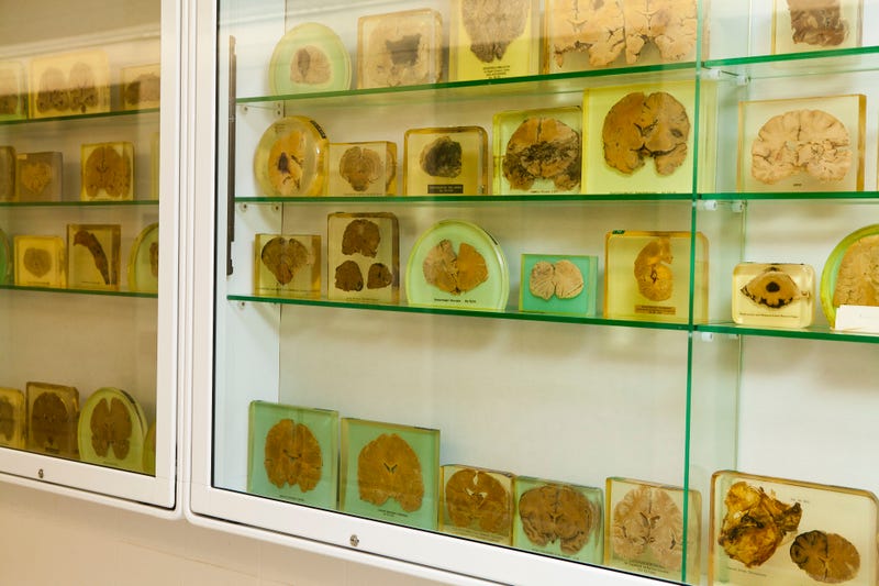 brain gallery