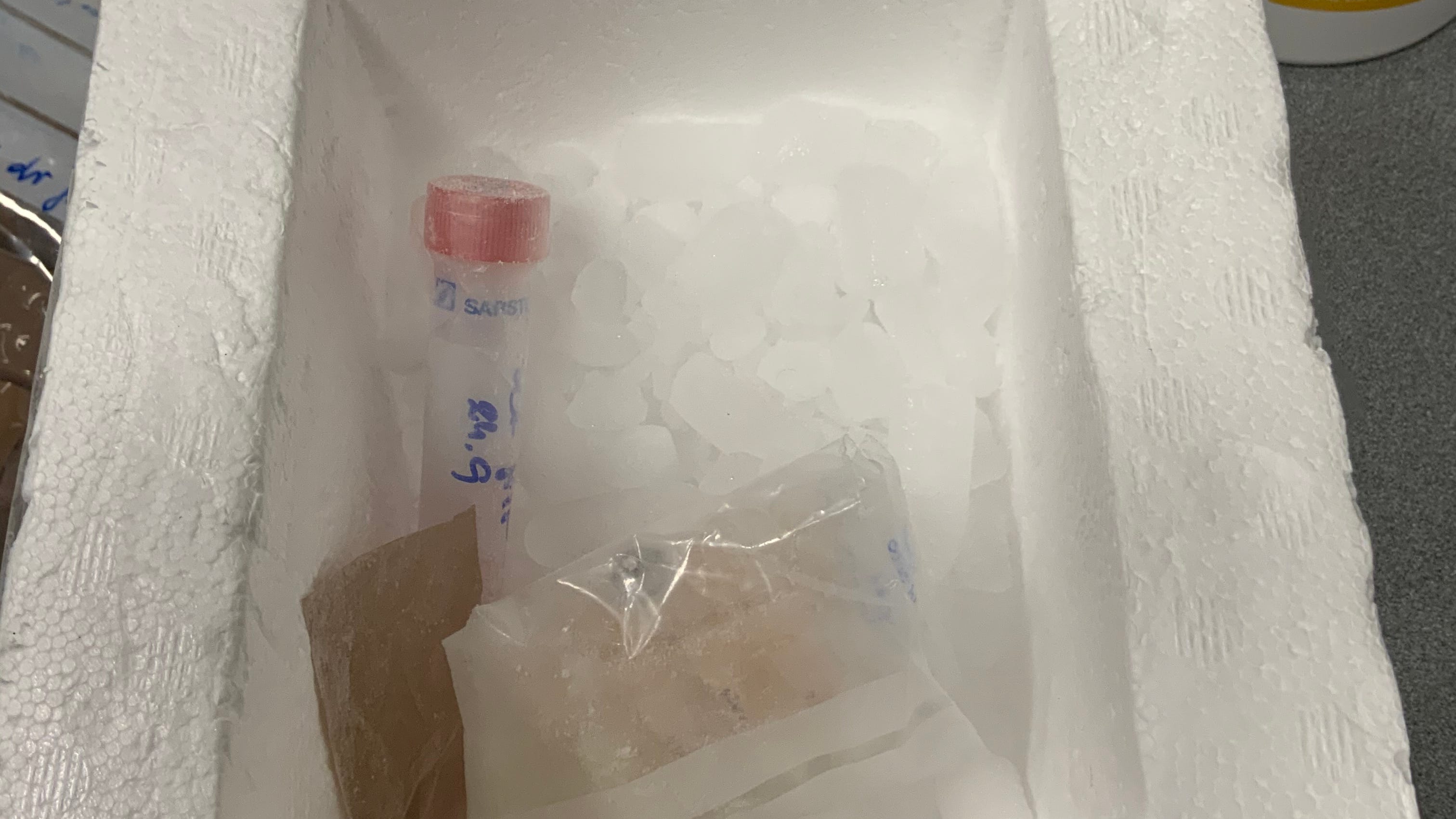 Traveler caught with undeclared biological materials at Detroit Metro Airport