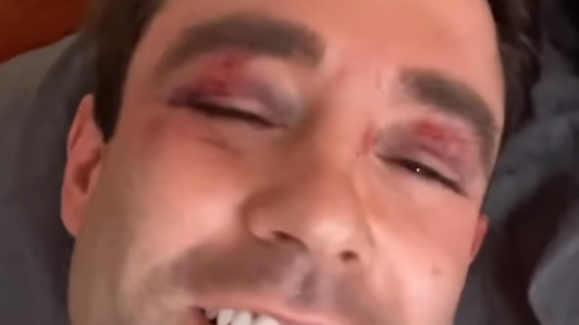 3 teens arrested after Fox News meteorologist beaten on Manhattan subway