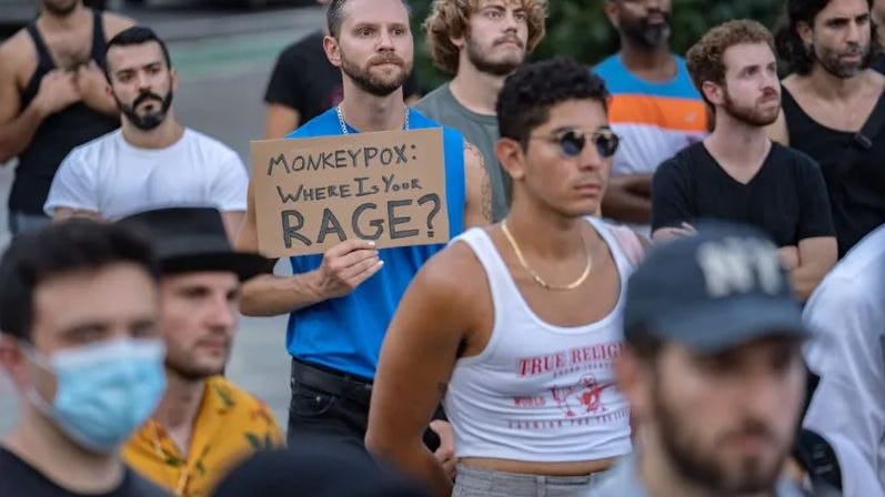 VIRUELA DEL MONO EN NYC: La ciudad supera los 1,000 casos mientras aumenta la presión por el acceso a la vacuna