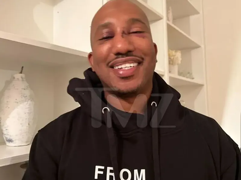 Chris Redd, in a photo obtained by TMZ published on Oct. 20, 2022, in the aftermath of an assault in NYC.
