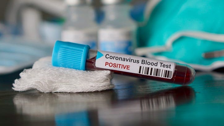 Getting a Coronavirus Test Isn’t Hard if You Are Rich and Famous