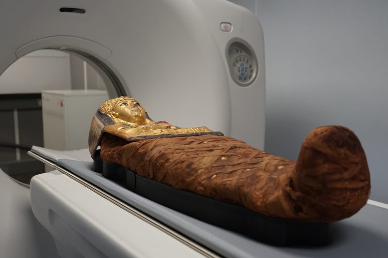 A mummy kept at the Field Museum in Chicago undergoes a CT scan, as part of an effort by researchers to virtually unwrap more than two dozen mummies in its collection. Some of the mummies are more than 3,000 years old.