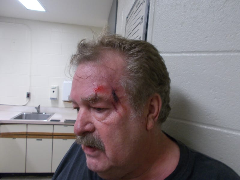 Larry White's injuries sustained during arrest in Madison Heights