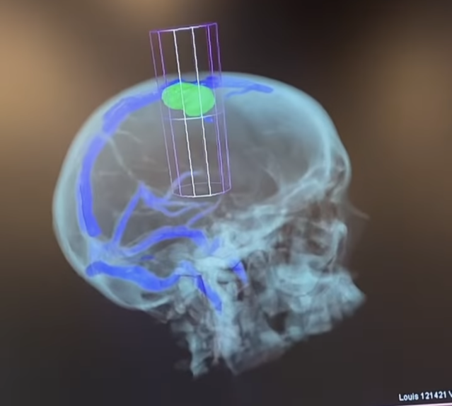 Wife of Cardinals' Albert Pujols, Deidre Pujols, announces brain surgery