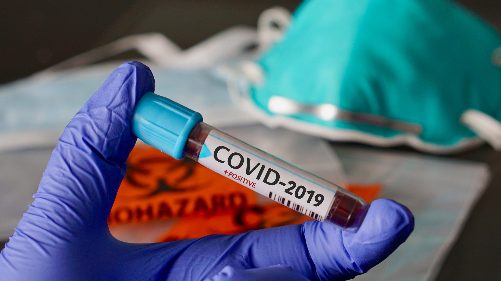 Coronavirus May Have Been Circulating in California Earlier Than First Suspected