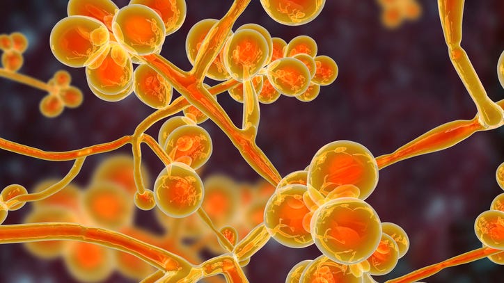 Oakland County man infected by rare, drug-resistant, often deadly fungus C. auris