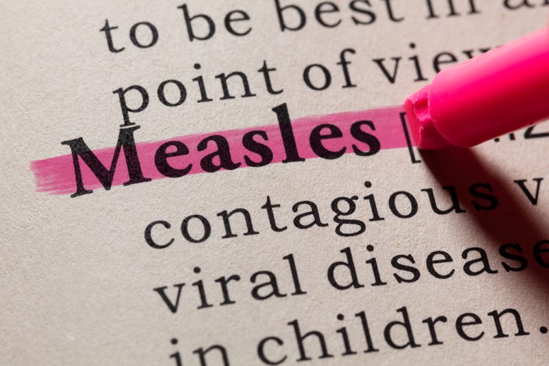 measles