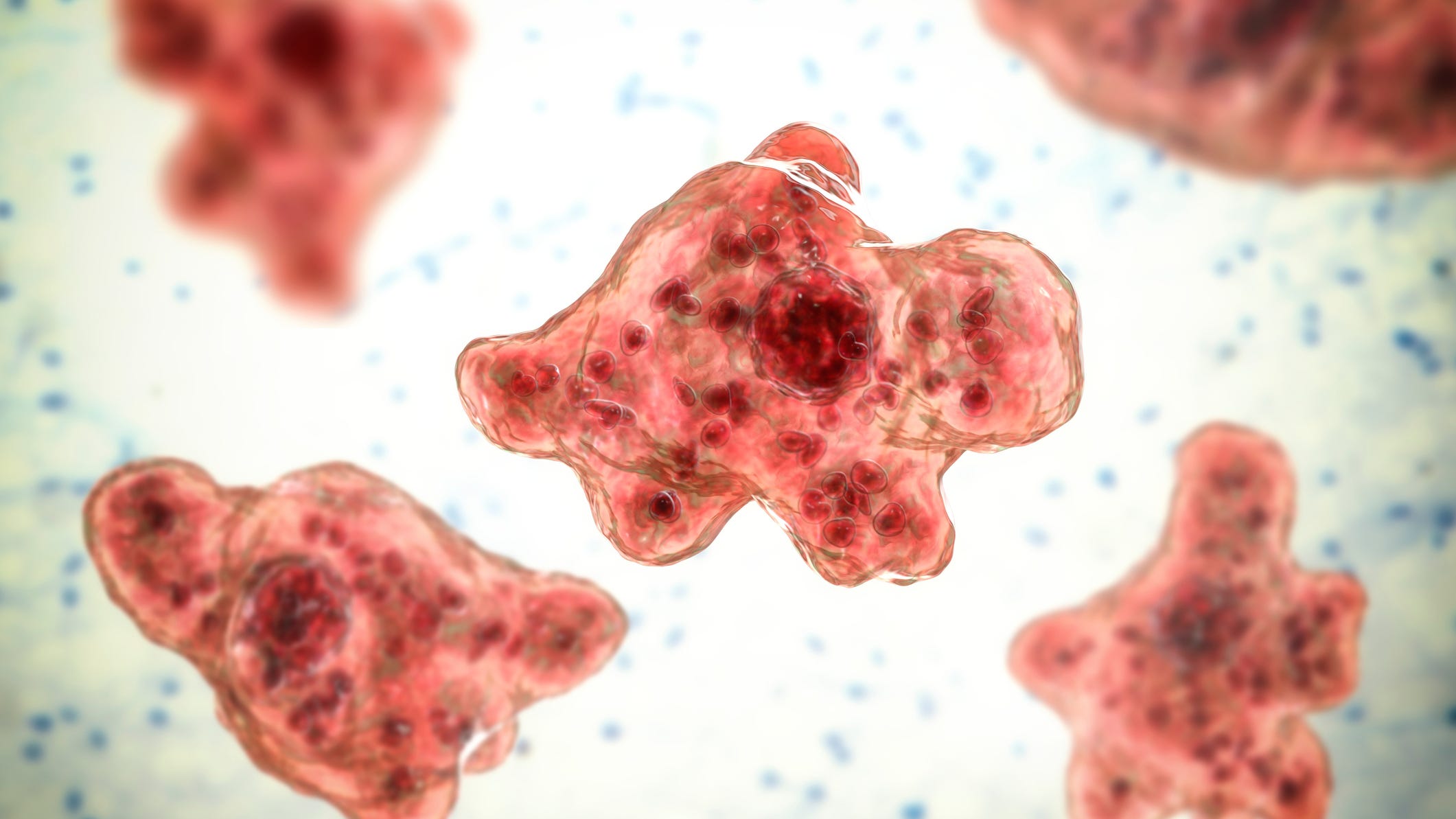 7-year-old California boy dies from brain-eating amoeba