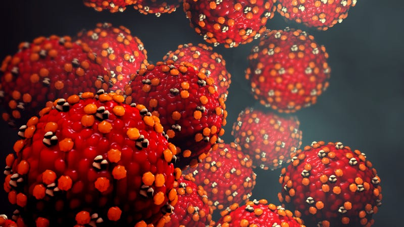 Measles case confirmed in LA County