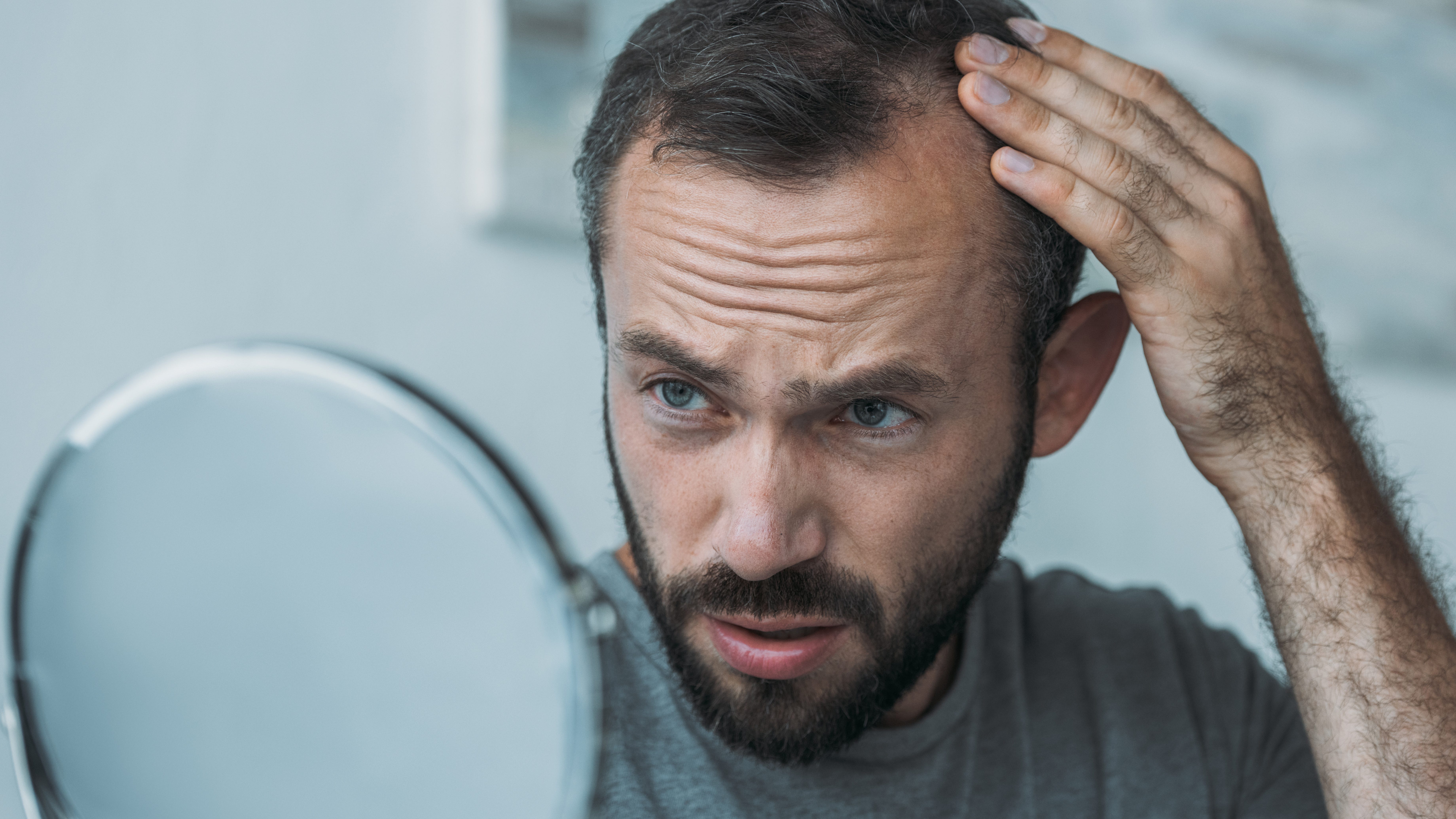 Balding? Hairy moles may hold the key to reversing hair loss