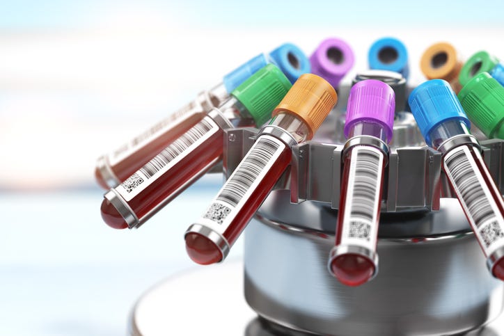 Blood test tubes in centrifuge