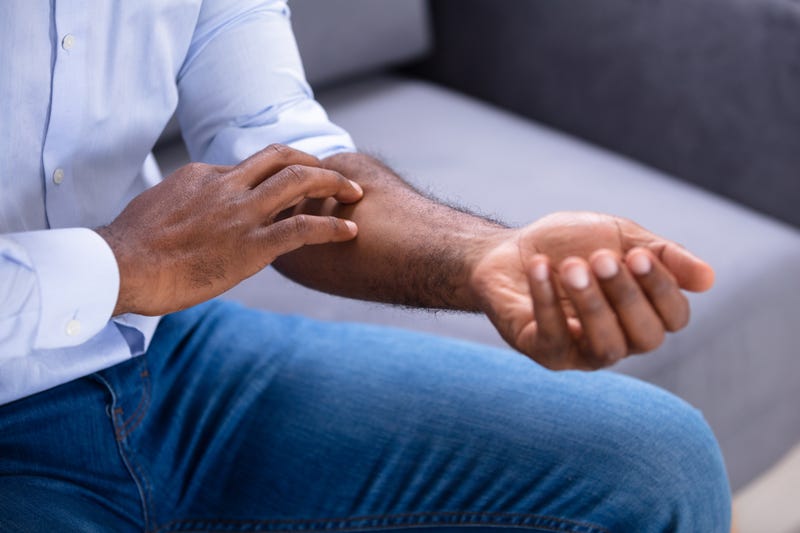 Man scratching his hand.