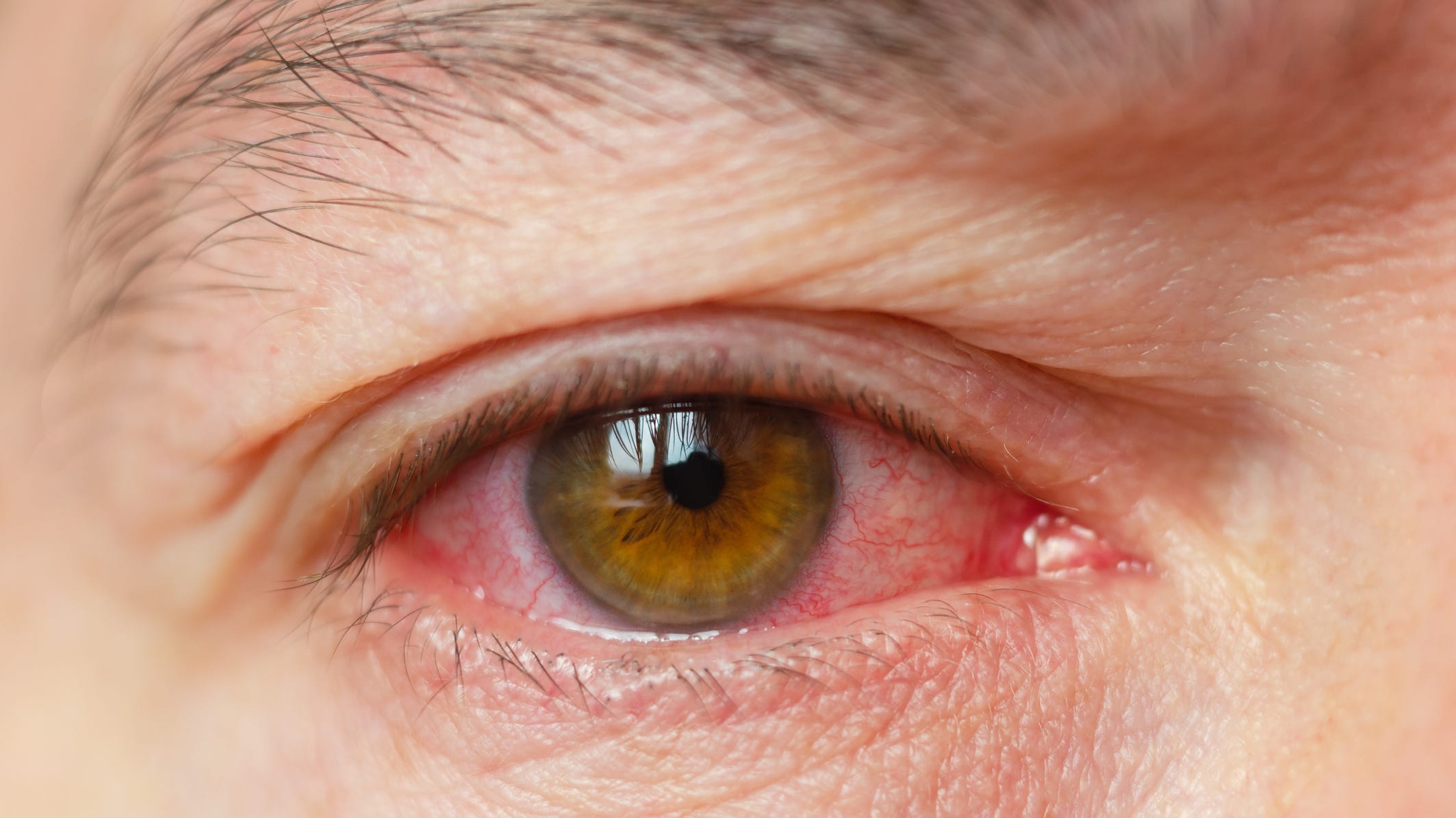 Expert warns new COVID variant sweeping world found in CA