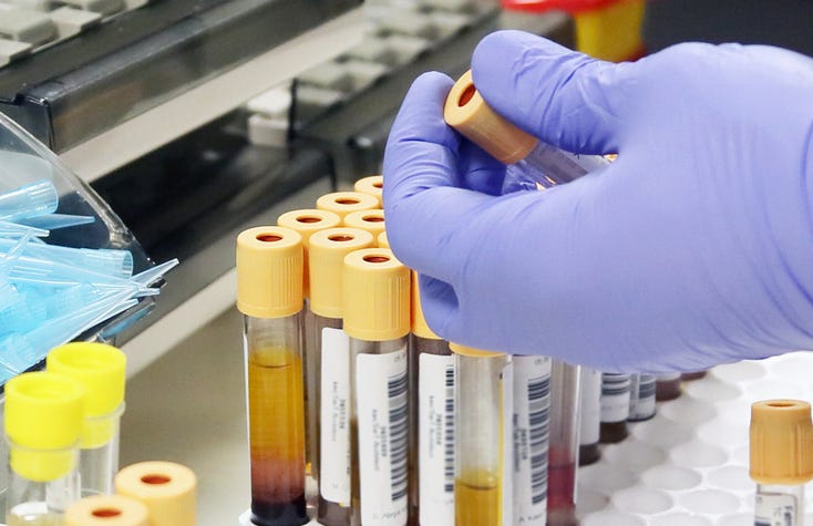 urine and blood test