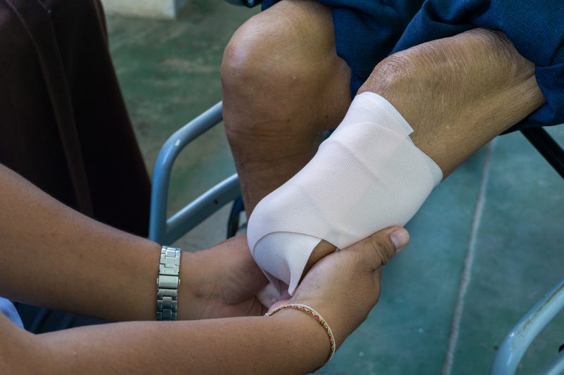 Tranq leaves bad sores where the user injects the drug, sometimes leading to amputation if necrosis occurs.