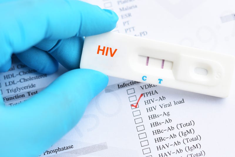 California Bill SB-306 went into effect on Jan. 1, requiring state-regulated private insurance providers to provide at-home STD testing to patients.