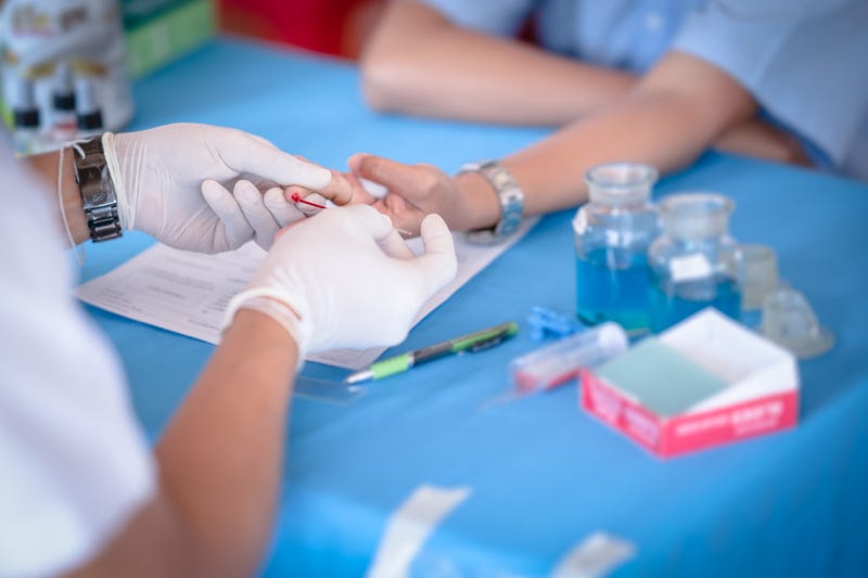 In the U.S., 94% of those individuals were hospitalized, and 8 had received liver transplants.