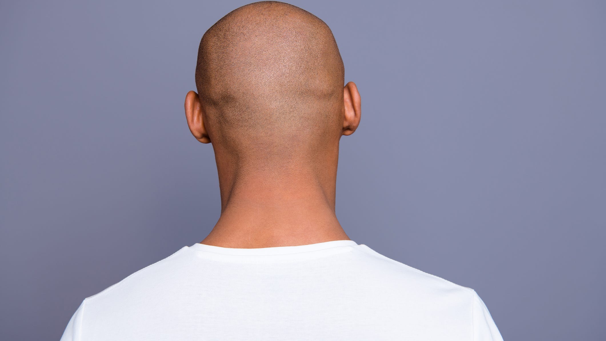 Calling someone 'bald' at work could be considered sexual harassment, per this lawsuit
