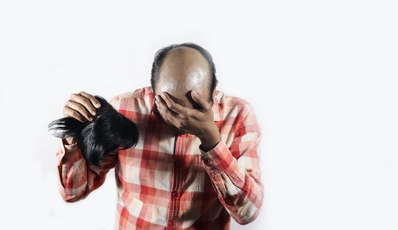 Bald Man, Wig