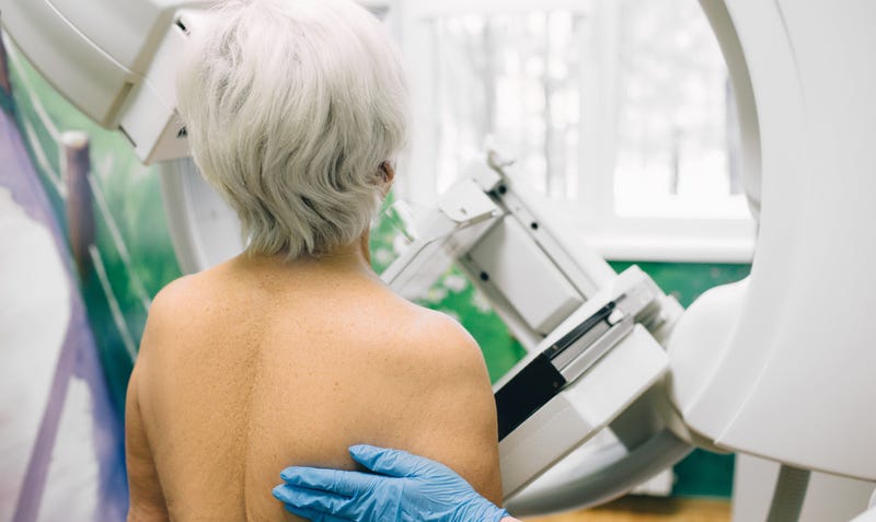 Breast cancer screening