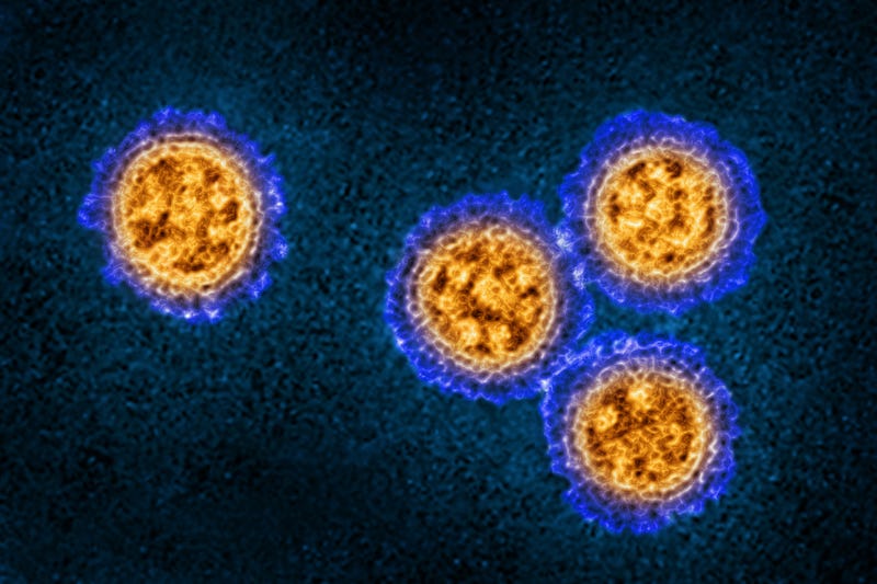 The influenza virus as seen from a transmission electron microscopy view