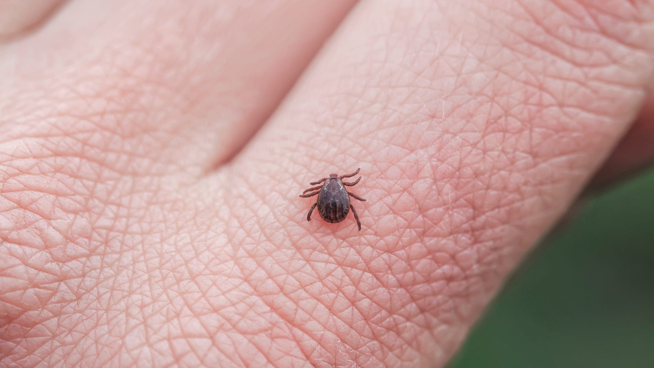 Beware of ticks: Macomb County Health Department warning residents of risk for Lyme disease
