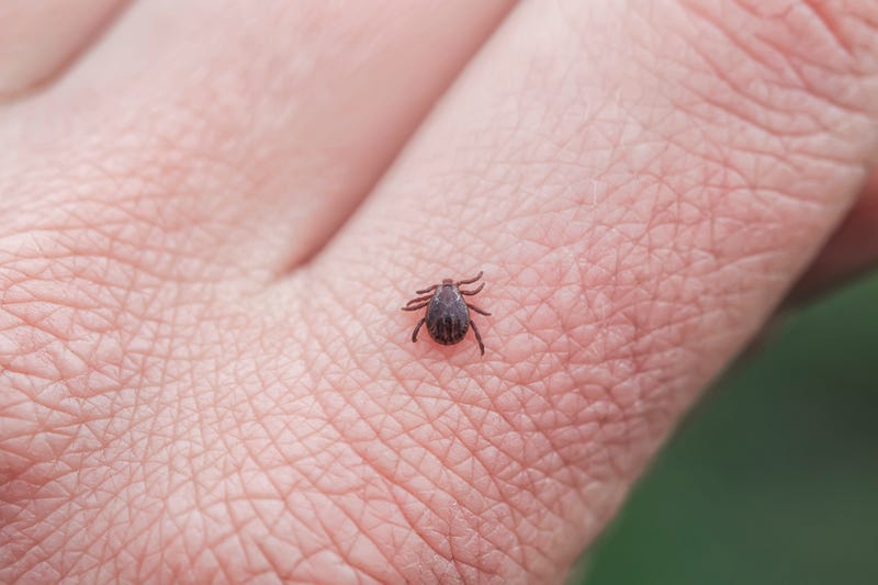 Tick on hand