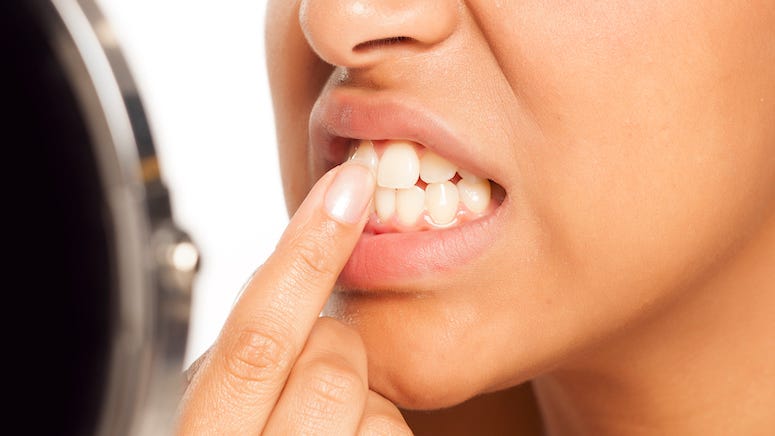 Dentists warn about TikTok trend of cleaning teeth with Magic Eraser