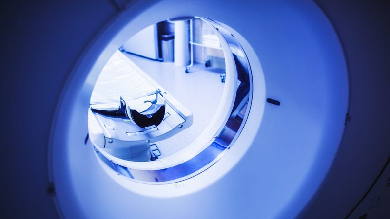 MRI scanner