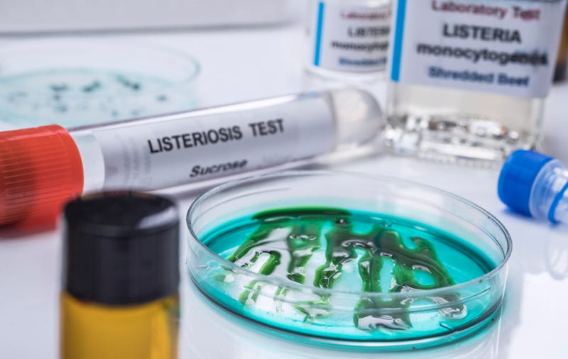 Samples you analyze of stuffed meat contaminated by bacterium of listeria in laboratory