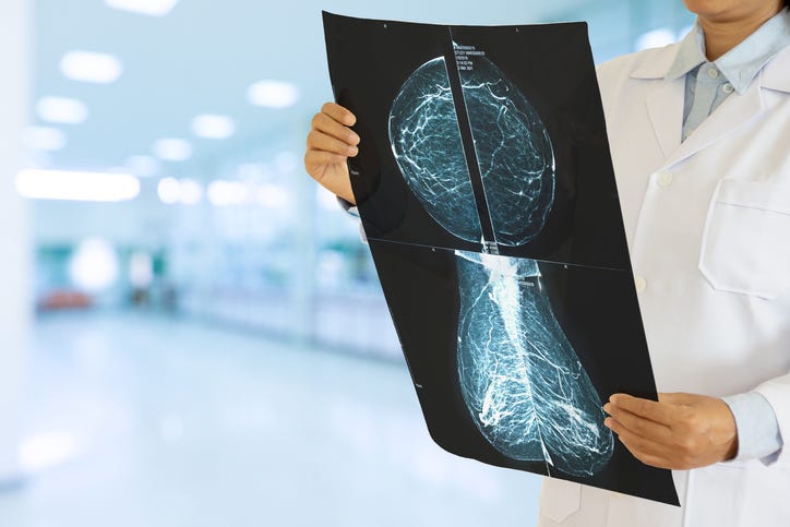 doctor holding mammogram