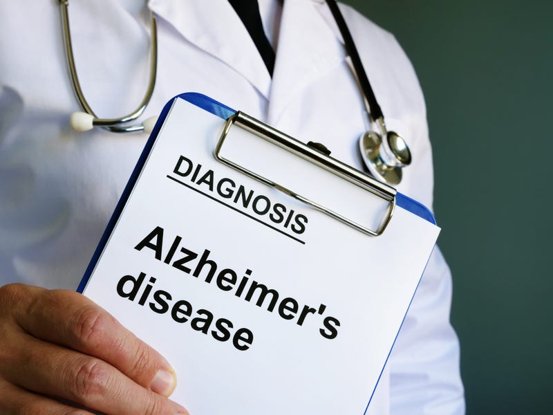Alzheimer's disease