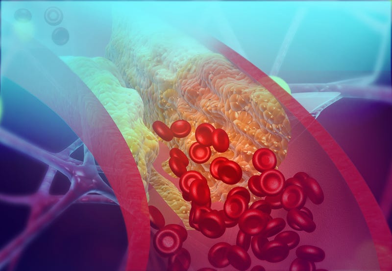 Blood clot