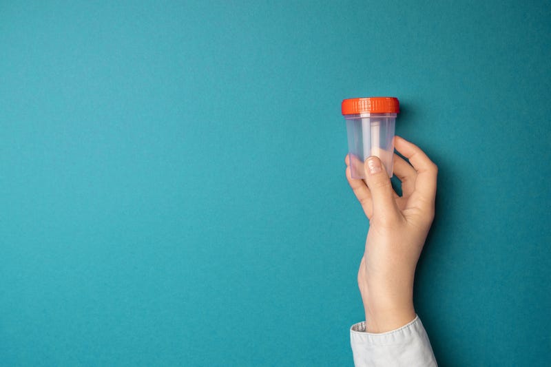 Doctor holding a cup for urine for drug testing.