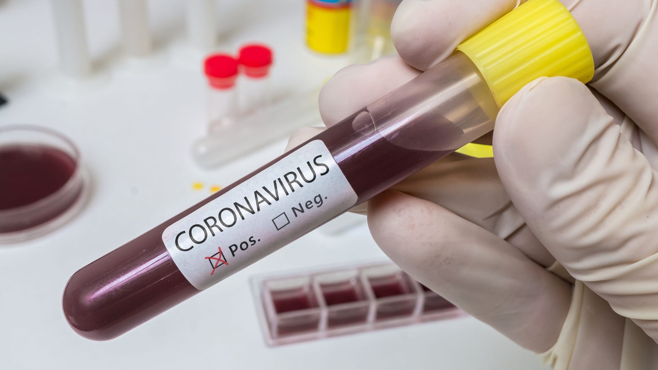 Patient Says Coronavirus Was 'Like Nothing I Had Ever Quite Experienced'