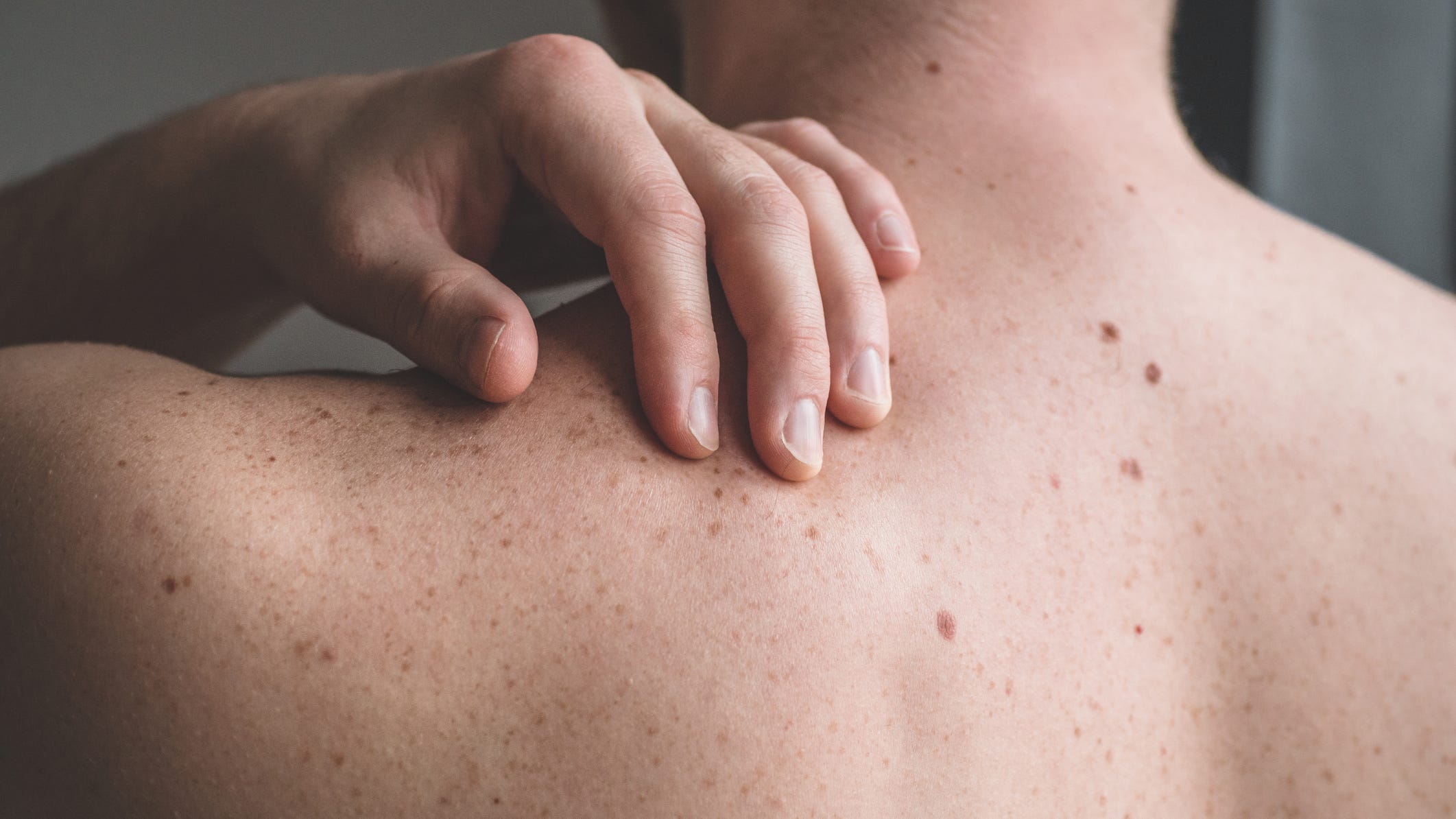 Easy tips to prevent skin cancer from UCSF health expert