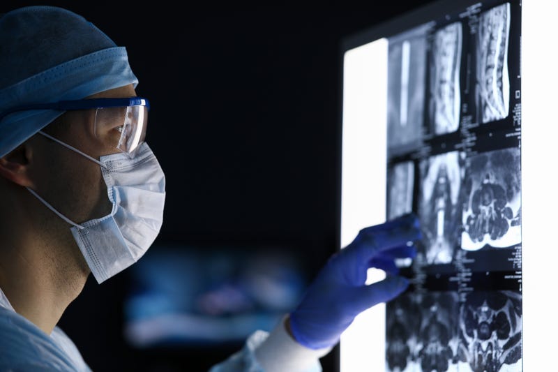 Surgeon looking at medical scans. 