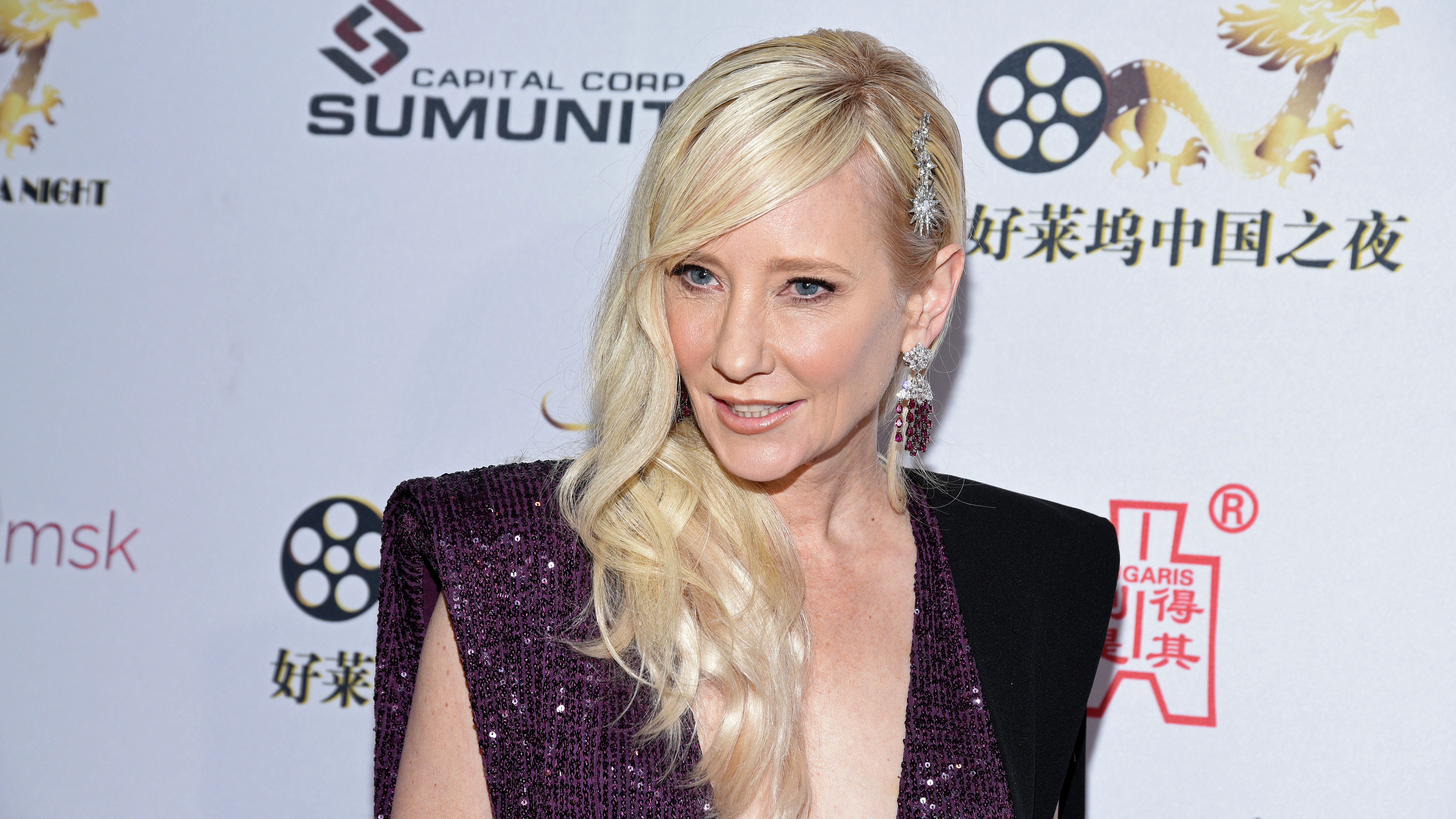 Actress Anne Heche in ICU Saturday after driving into a Los Angeles home