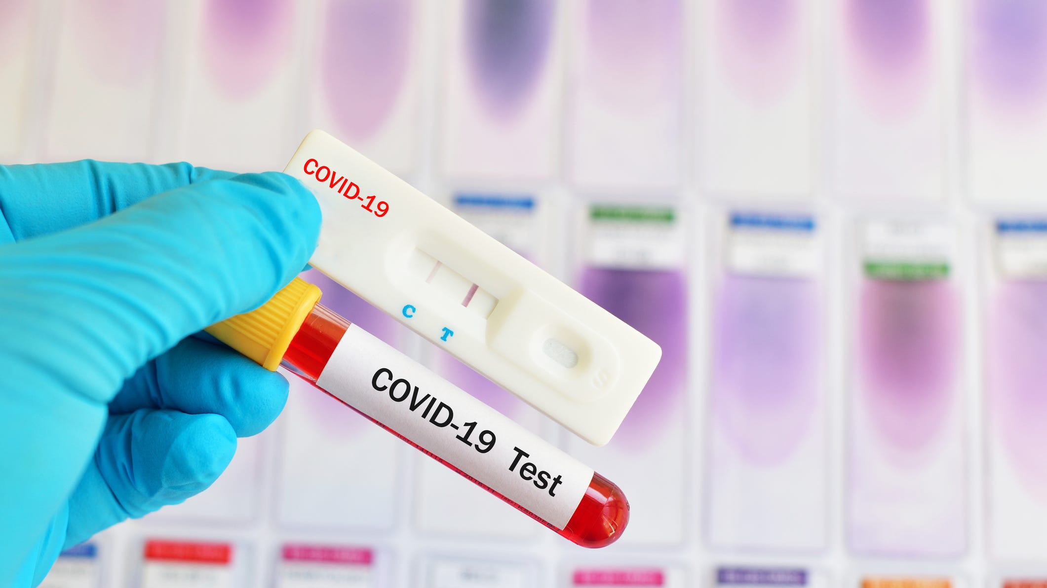 CDC Changes COVID-19 Guidance on How Long Patients Need to Self-Isolate